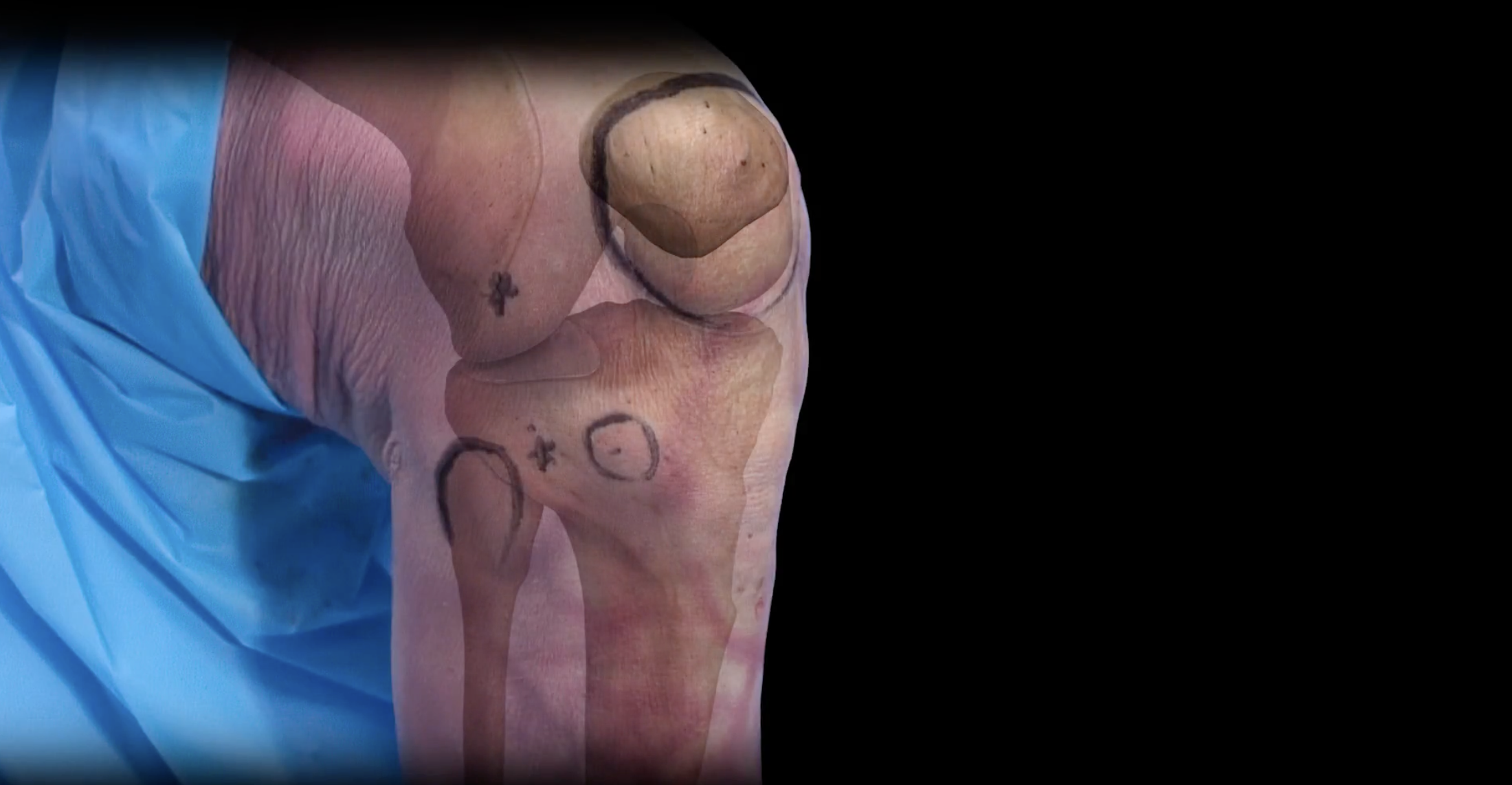 Overview / Anatomy — Jonathan Koscso, MD